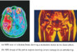 Nuclear Magnetic Resonance Imaging - NMR imaging
