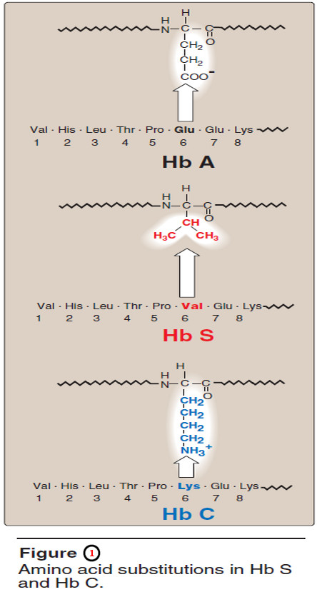 Hemoglobinopathies