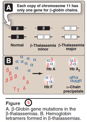 Hemoglobinopathies